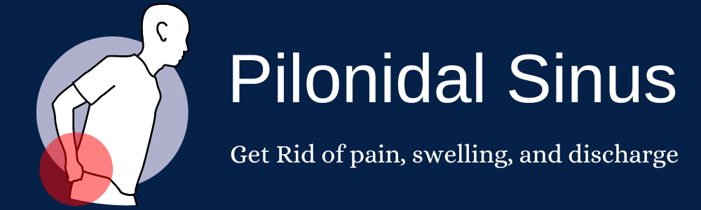 Best pilonidal sinus treatment in delhi